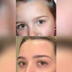 Does Eye Color Change With Age