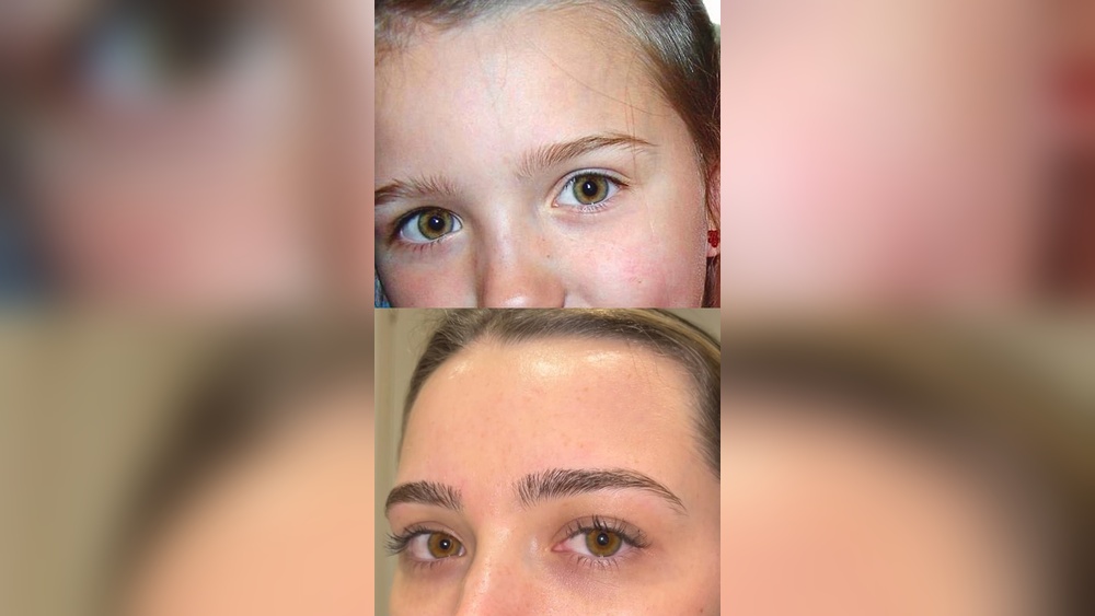 Does Eye Color Change With Age