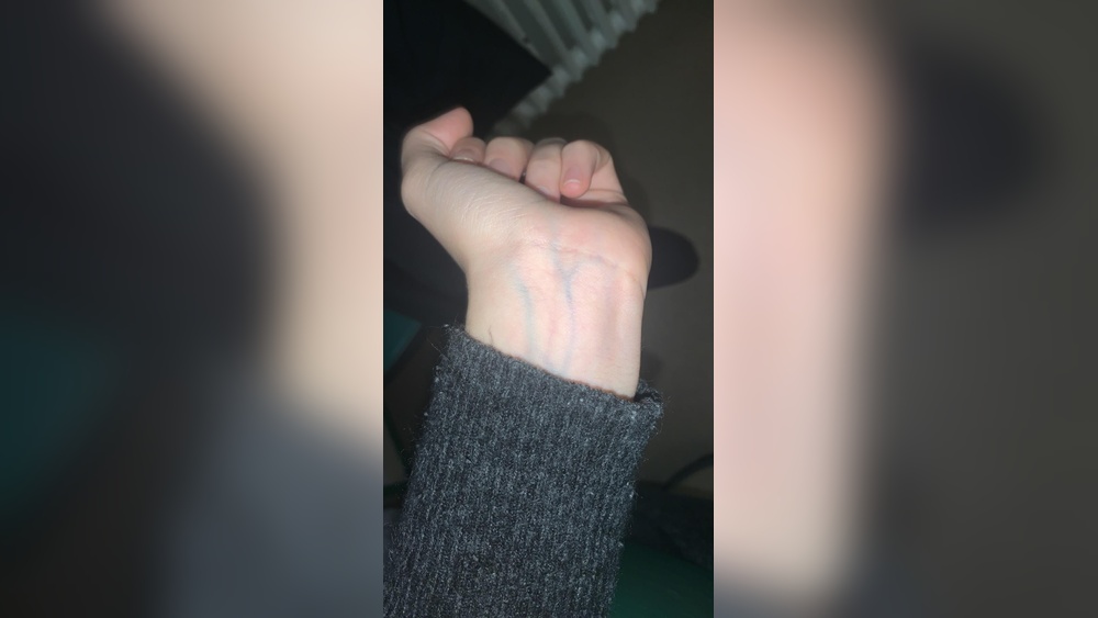 Why are Veins Blue in Color